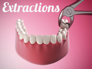 tooth extractions the woodlands texas